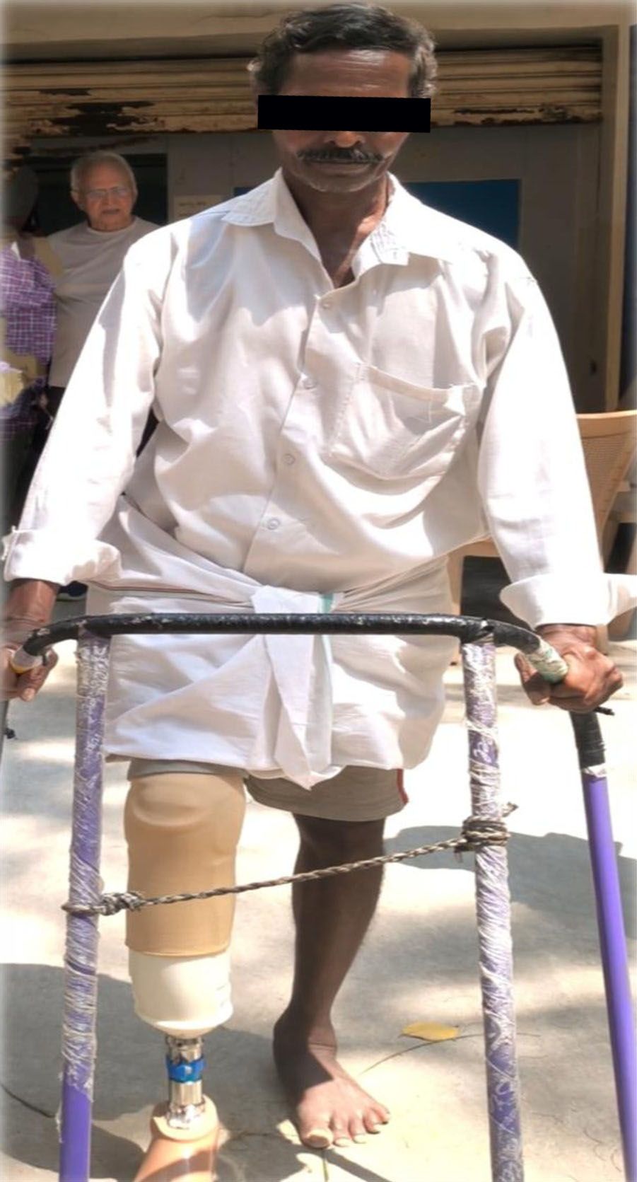 A man walking with a prosthetic leg and a walker