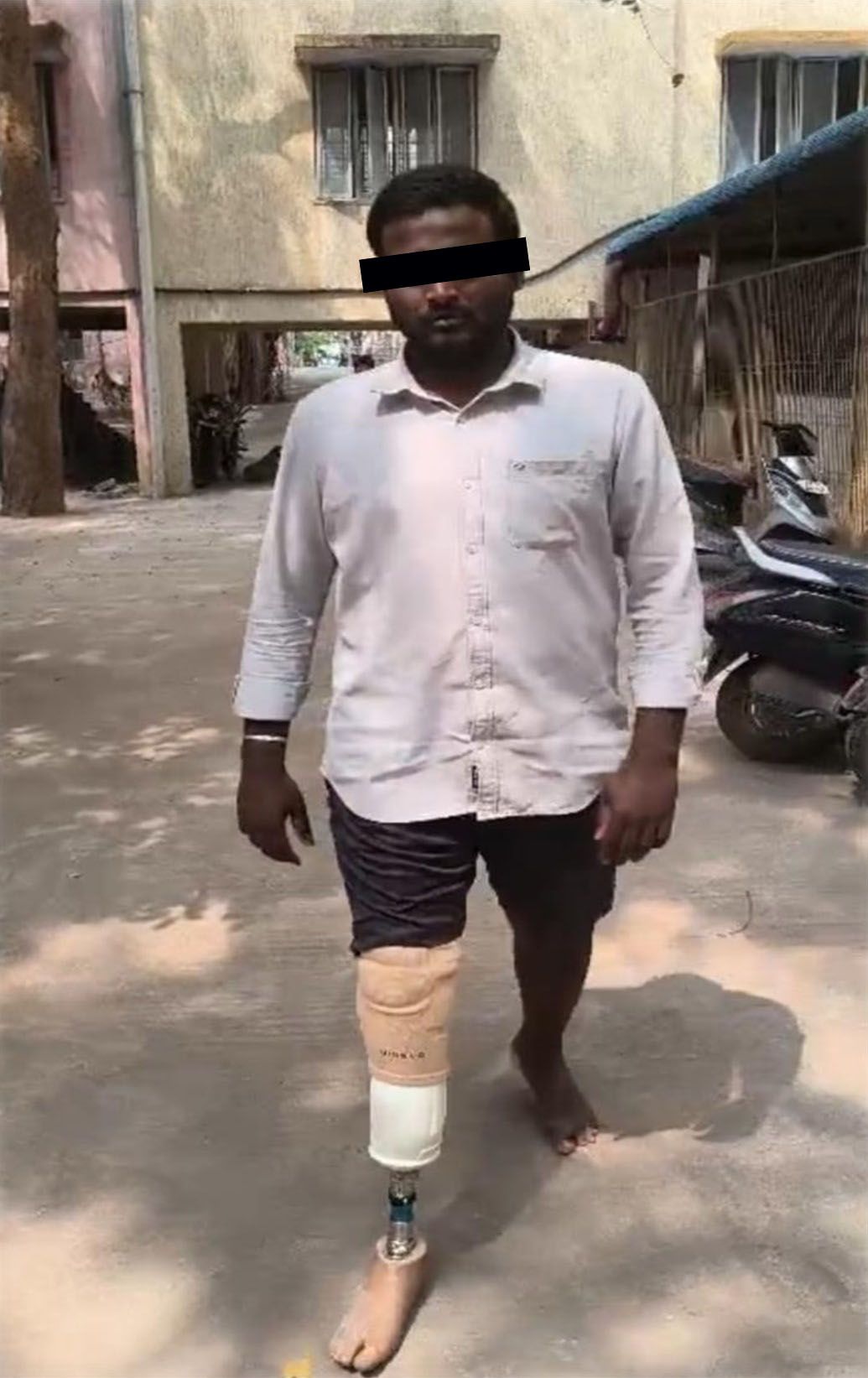 A man with a prosthetic leg