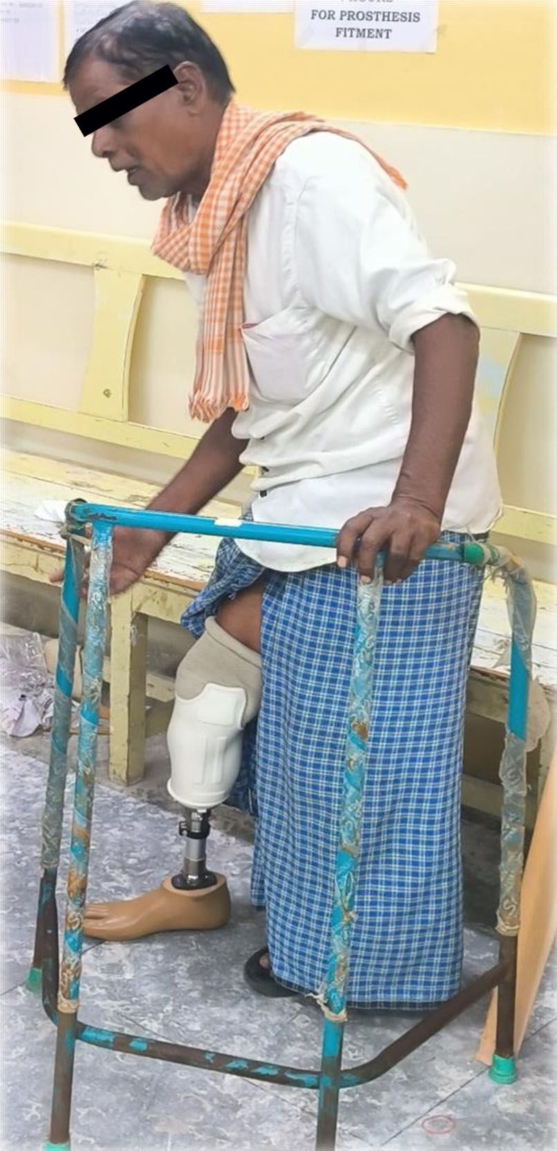 Man using walker with prosthetic leg during rehabilitation session