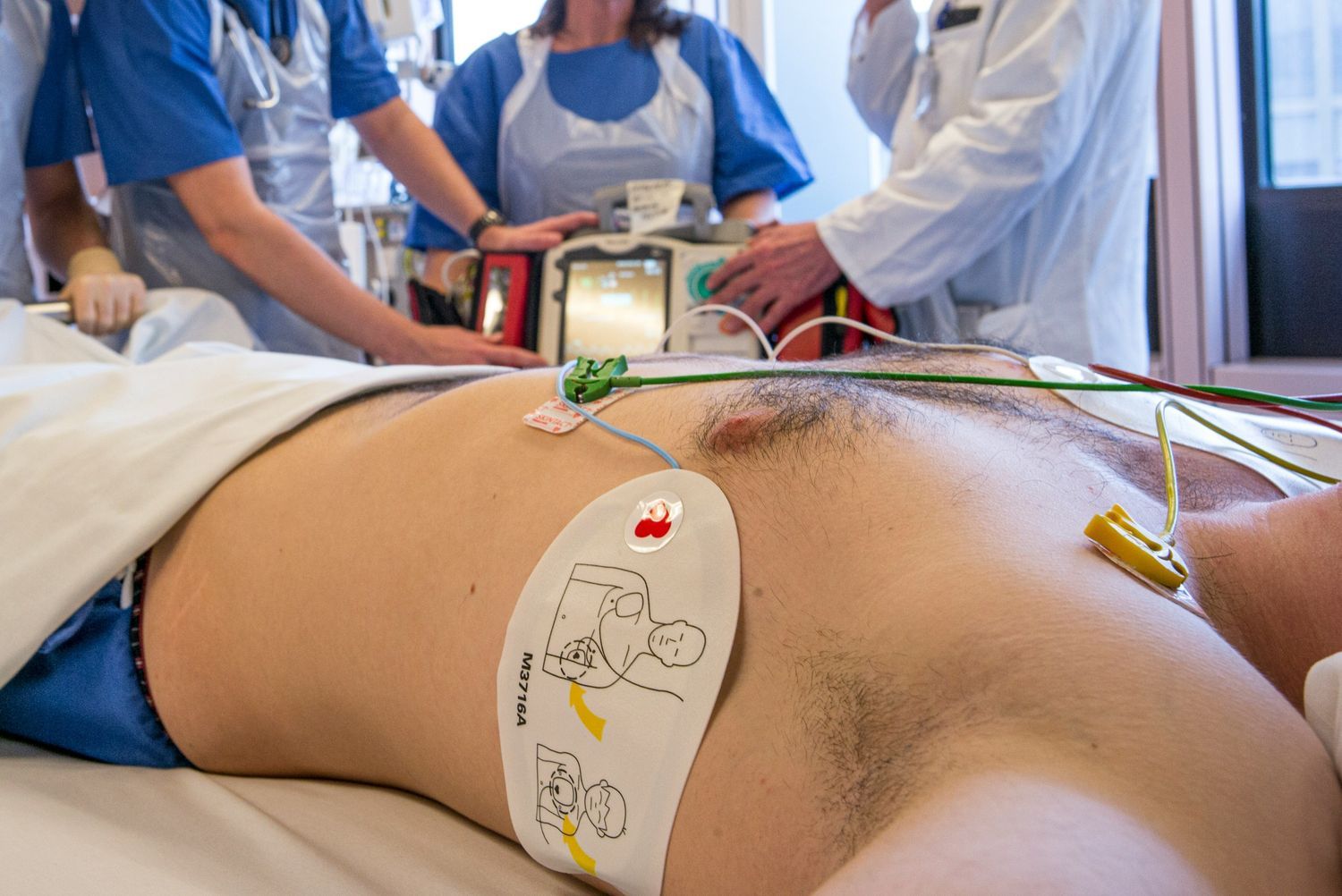 Medical team performing emergency cardiac resuscitation using defibrillator on patient
