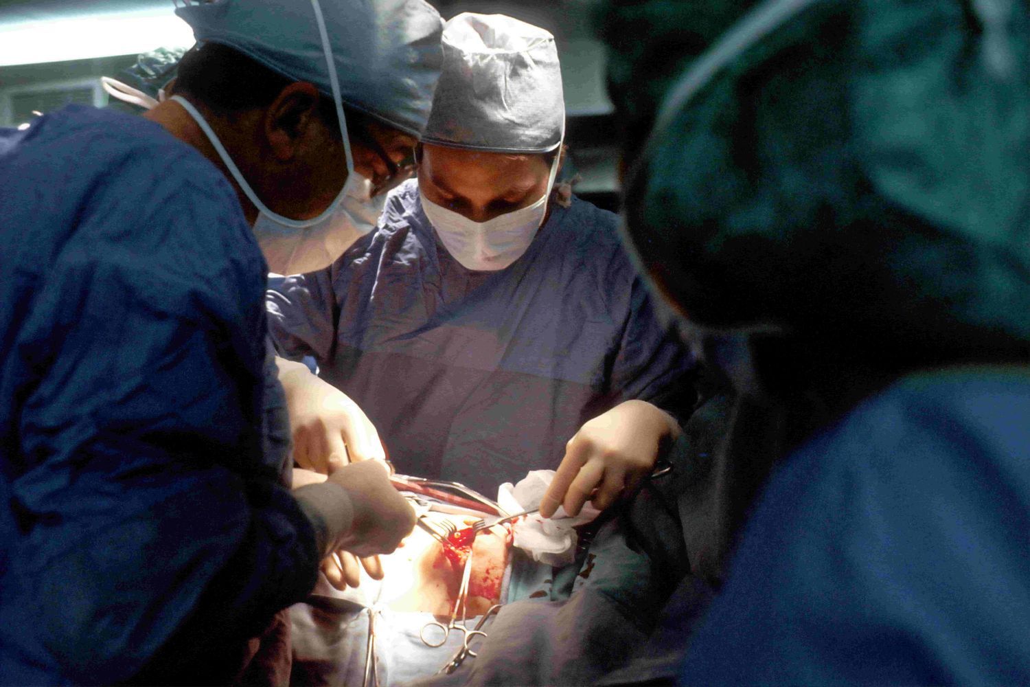 Surgeons performing a critical operation in an operating theatre with full sterile precautions